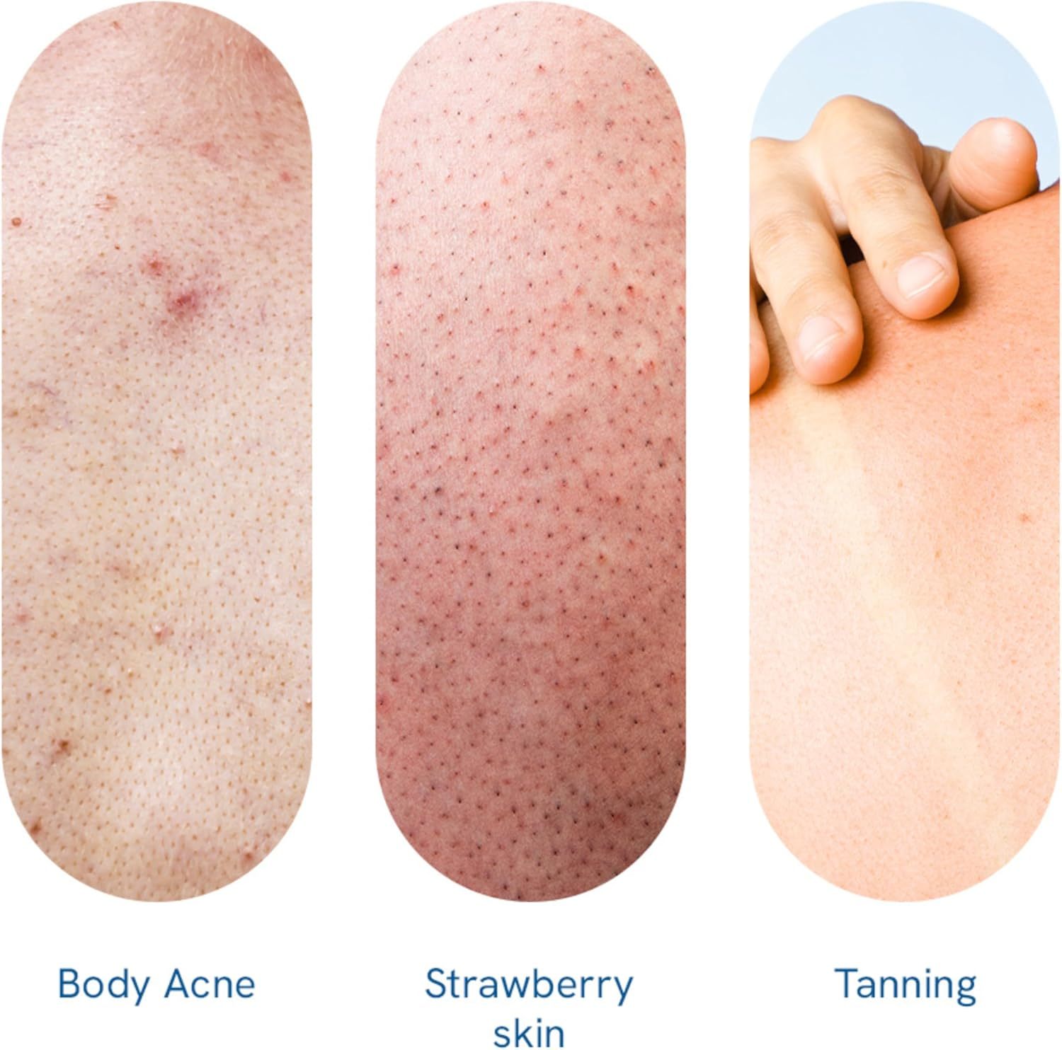 Be Bodywise 10% Lactic AHA Exfoliating Body Scrub 200G | Tan Removal & Soft-Smooth Skin | De-Tan Bathing Scrub with Centella Water & Aloe Vera, Removes Dirt & Dead Skin from Neck, Knees, Elbows & Arms | All Skin Types image number 3