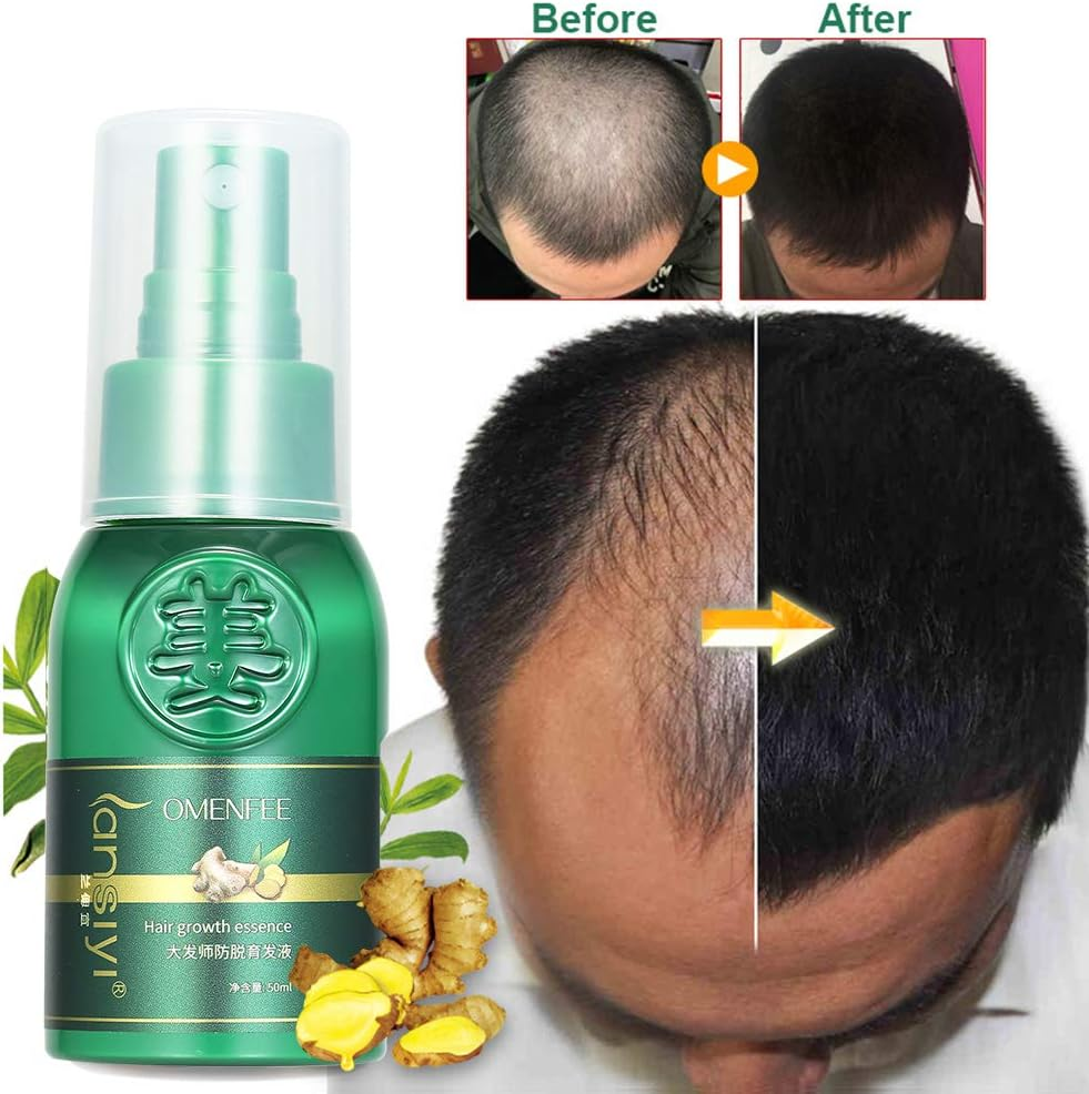 Chusui Hair Growth Essence 30Ml Effective Scalp Nutritious Repair Hair Growth Enhance Tool Hair Care Healthy Hair Growth Essence Oil image number 6