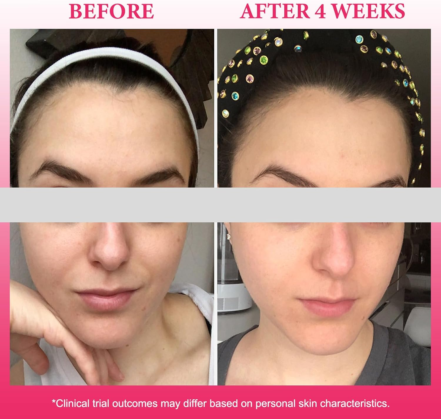 SIMTWO Facial Steamer, Nano Ionic Face Steamer for Facial Deep Cleansing, Warm Mist Facial Steamer Humidifier for Home Facial Sauna Spa, 70Ml Capacity, 15Min Running Time image number 1