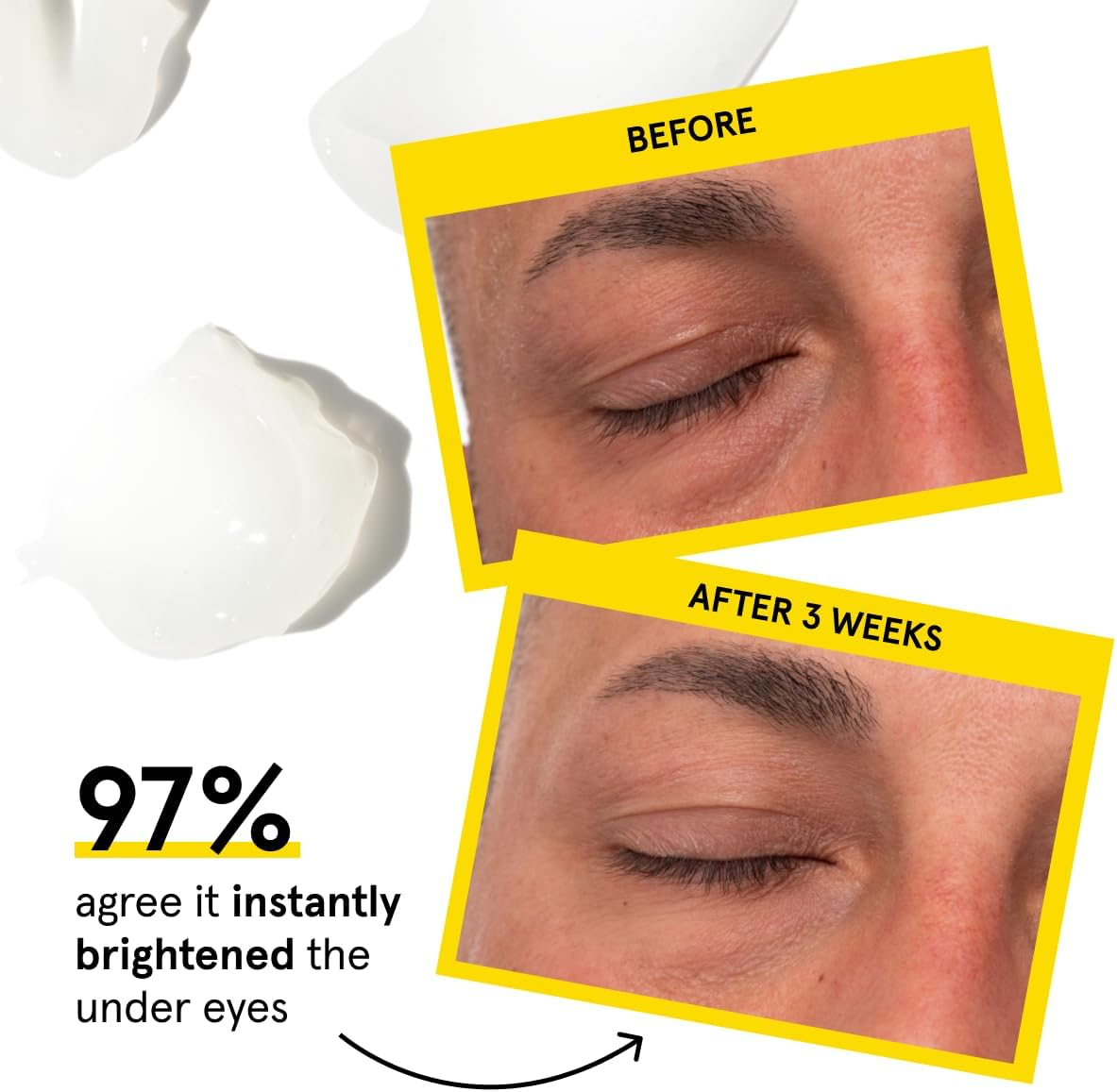 Men&rsquo;S Dark Circle Defense (1 Oz.): Anti-Aging Korean Formulated Eye Cream Treatment - Reduce Fine Lines, Wrinkles, Eye Bags, Dark Circles - Experience a Rejuvenated Complexion - Achieve Your Best Look