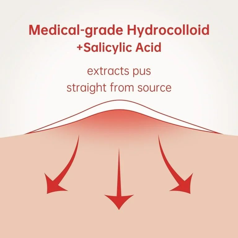 AWESOME DOTS Acne Pimple Patch - Invisible Blemish Cover - Spot Treatment - 2 Sizes (38 Count) - Face - Unisex - Vegan image number 3