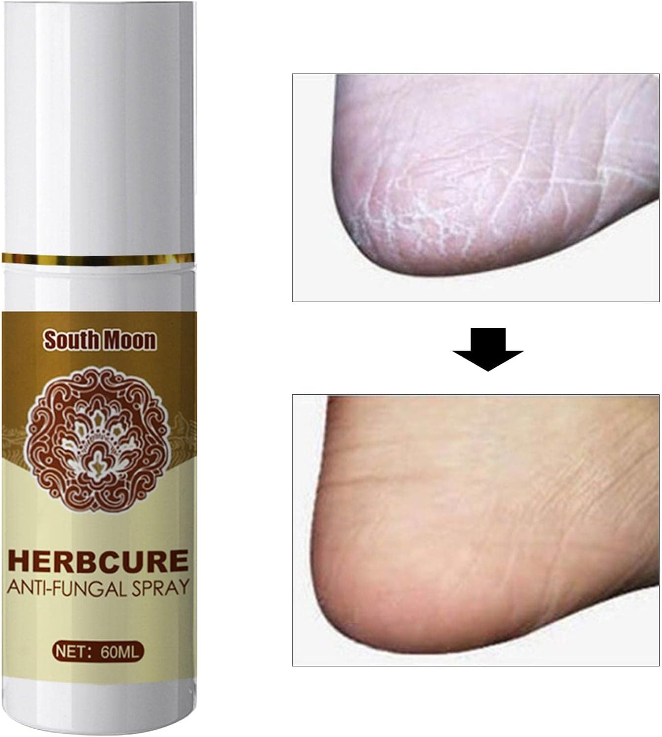 Foot Spray Anti-Fungal Infection Beriberi Spray Damaged Skin Moisturizer image number 2