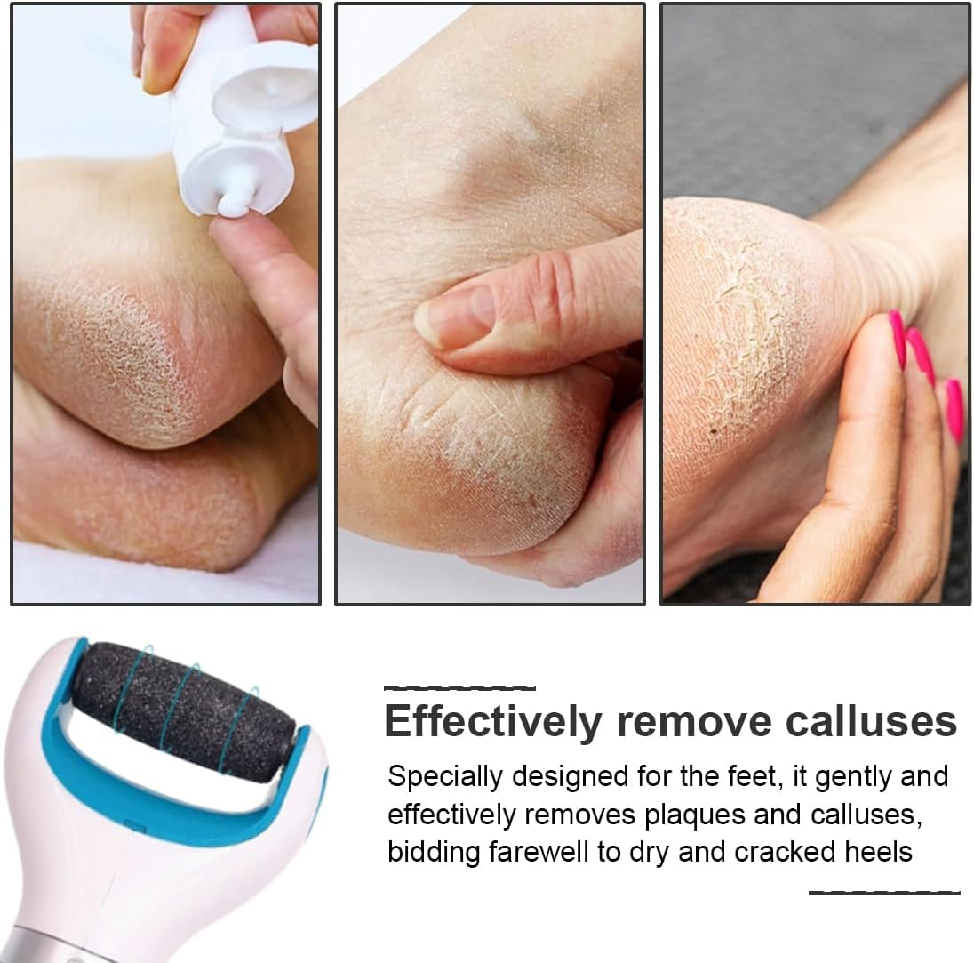 OUDQFCJ Pack of 8 Replacement Rollers, Extra Coarse Refills, Compatible with Scholl Velvet Smooth for Scholl Callus Remover, Pedicure, Foot Care Set for Removing Hard Skin image number 5