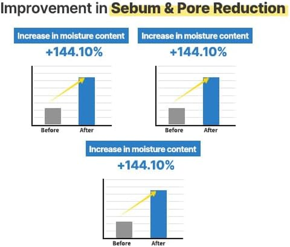 S.NATURE AQUA SQUALANE Serum｜Sebum Control, Pore Care, Inner Moisture, Calming｜1.69 Fl.Oz, 50Ml image number 2