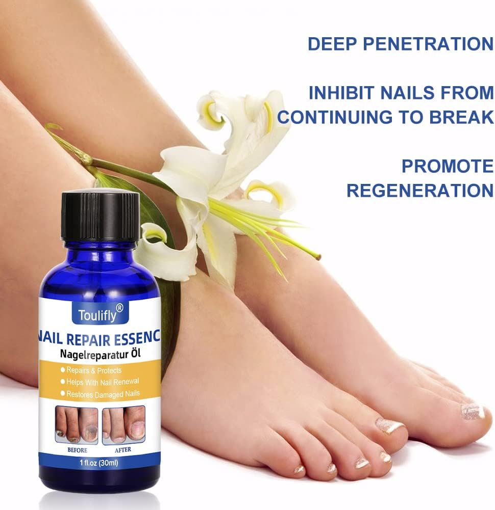 Nail Care and Treatment, Nail Repair, Nail Care for Healthy Foot and Hand, Nail Oil, Nail Care Oil, Nail Care Nourishing, Nail Essence Serum, for Broken and Discoloured Nails image number 1