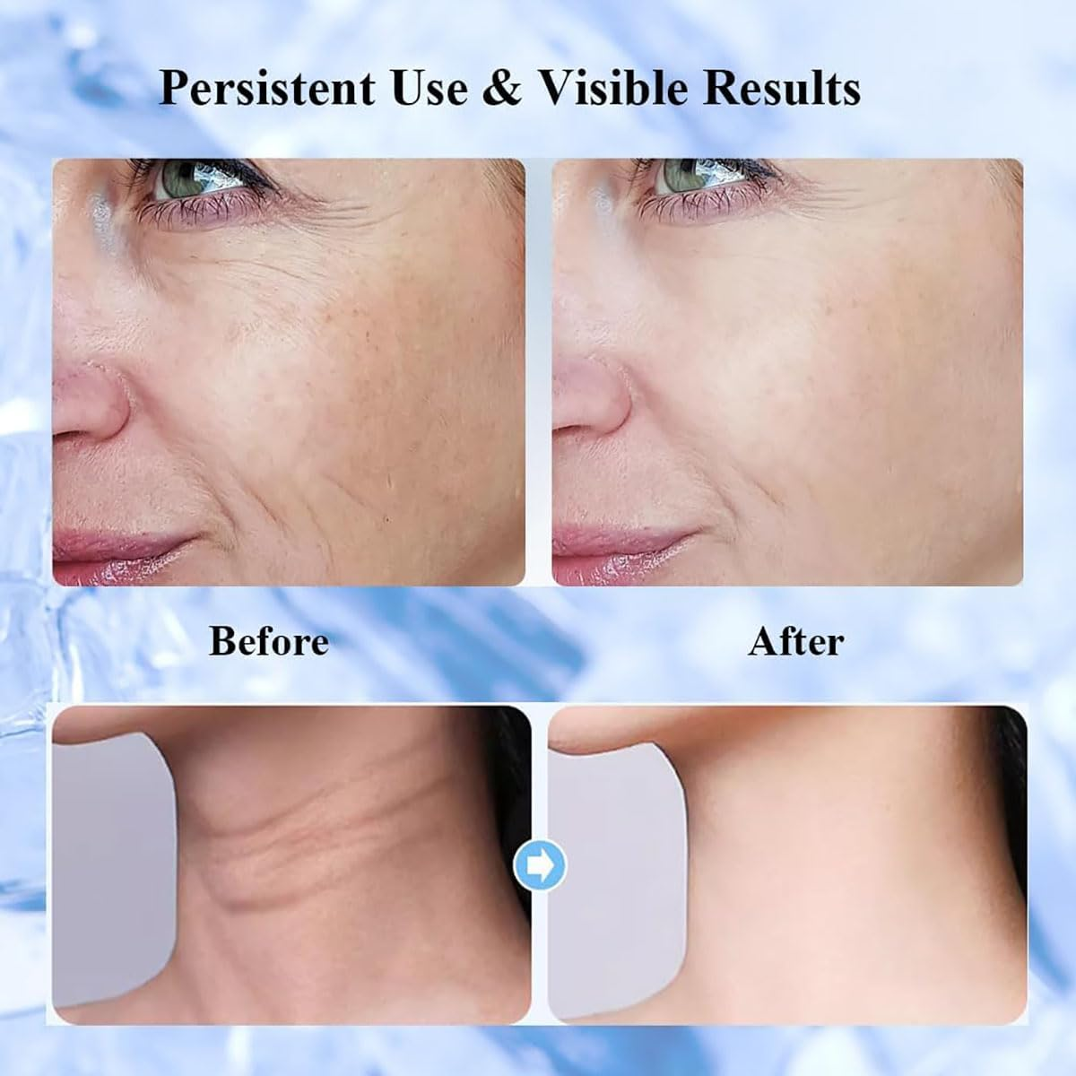 BEAUTY Face Massager with Cooling Mode, 6 Skin Care Tools with 4 Light Sources, EMS Microcurrent Red Light Therapy, Household Facial Carving Tools, Female Gifts image number 1