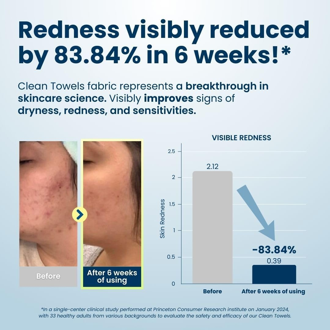 CLEAN SKIN CLUB Clean Towels Xl,World'S 1ST Acne Fighting Biodegradable Face Towel, Dermatology Tested & Approved, Super Soft for Sensitive Skin, 200 Count (Save 15%) 1