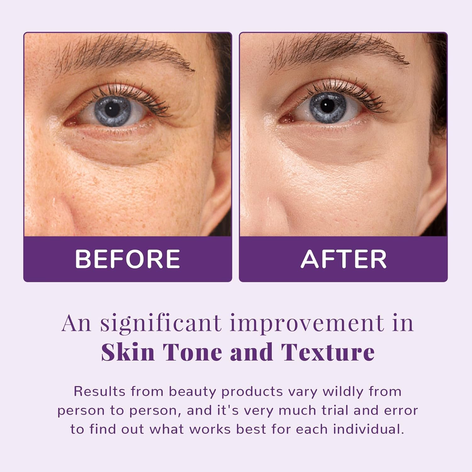 ANAI RUI Niacinamide Facial Radiance Pads, with Glutathione, Niacinamide, LHA, PHA - 50 Pads for Even Skin Tone, Reduce Blemish and Spots image number 4