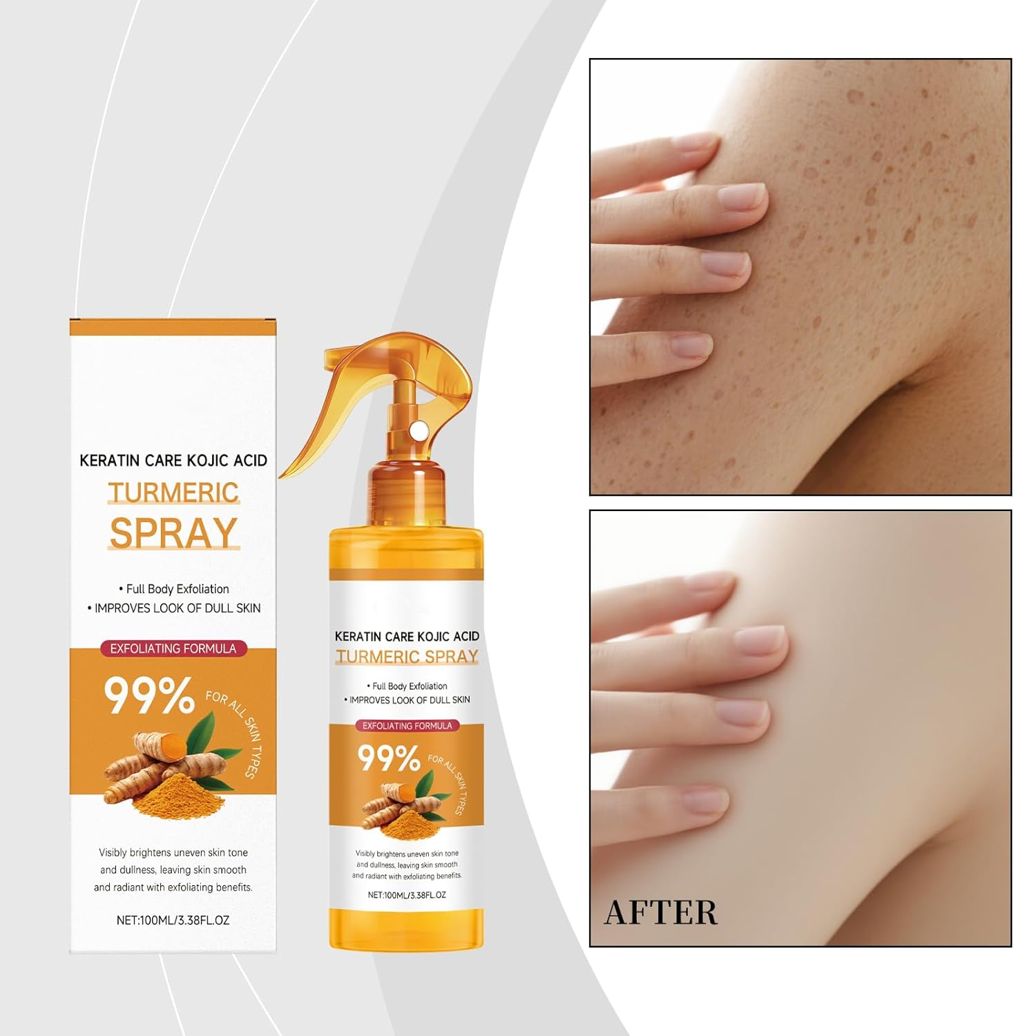 Peel Shot Keratin Care Turmeric Spray, Turmeric Exfoliating Spray with Retinol, Gentle Moisturizing, Nourishes the Skin, for Face and Body, Peeling Solution Skincare All Skin Types (6PCS)