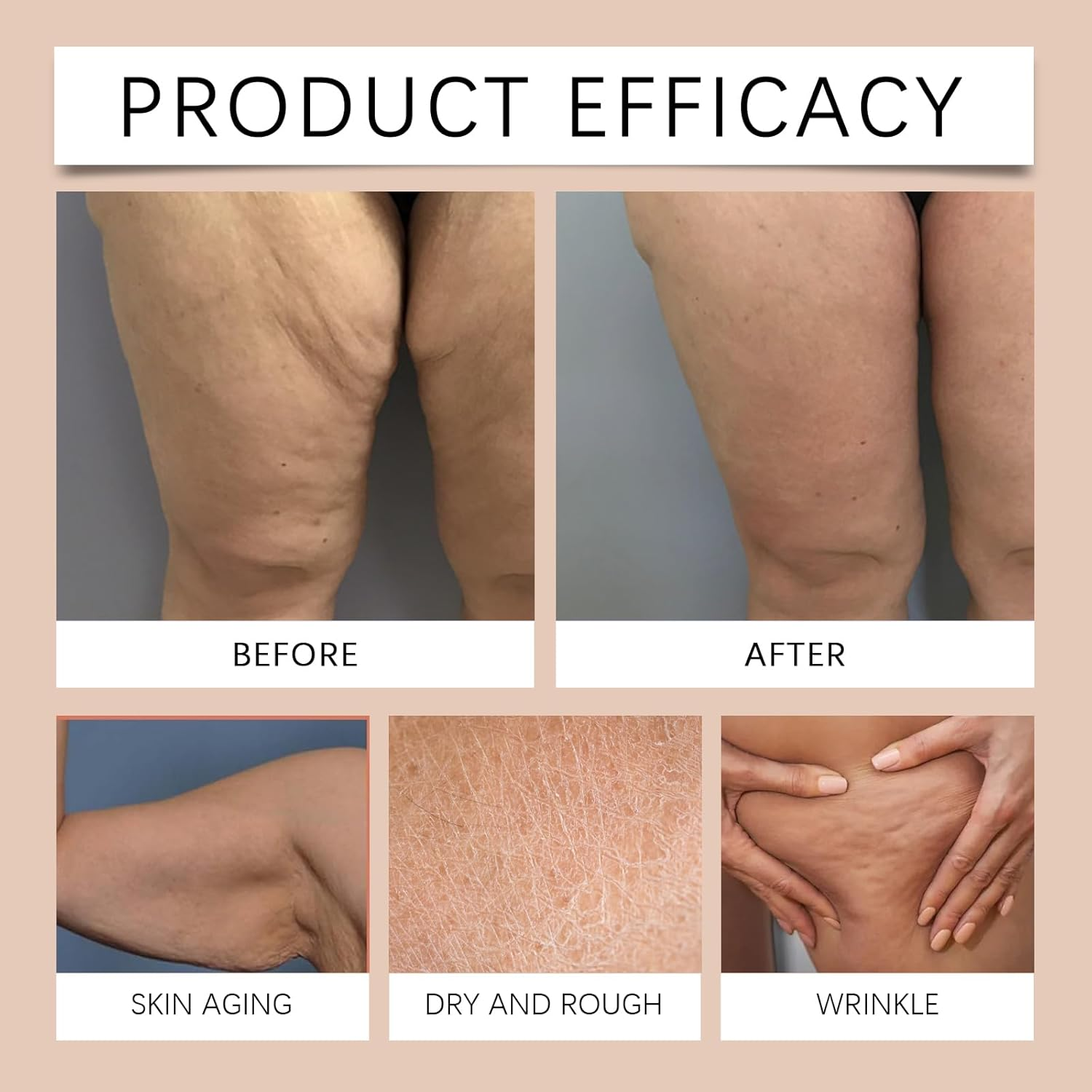 Glows Remedy Oil Skin Tightening, Lift Firming Body Oil, Body Firming Massage Oils for Dry Sagging Skin, Reduces Fine Lines, Wrinkles & Stretch Marks, Non-Greasy Moisturizer Bodys Oils. (3PCS) - 3Pcs image number 3