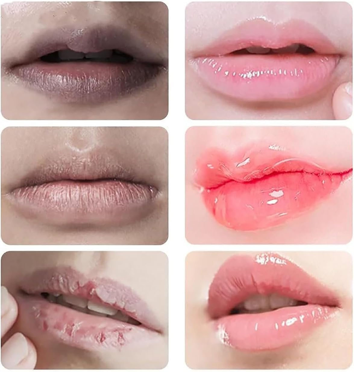 JINSHANE Lip Serum, Jinshane Lip, Jinshane Lip Brightening, Jinshane Dark Lip Treatment, Lip Fresh Treatment Remove Dark Lip, Lip Balms Moisturizer Nourishing Essence (6Pcs) - 1Pcs image number 3