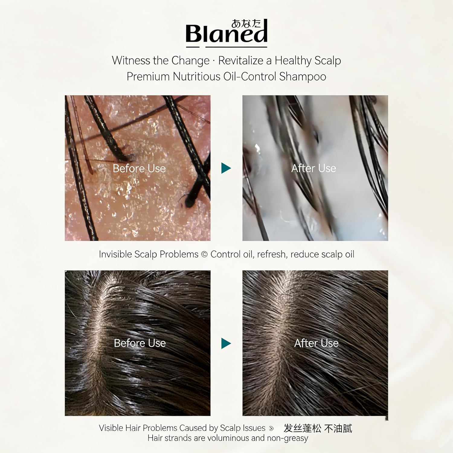 Blaned Jing She Oil Control Shampoo, Premium Nutritious Formula for Oily Scalp and Flat Hair, 500Ml image number 1