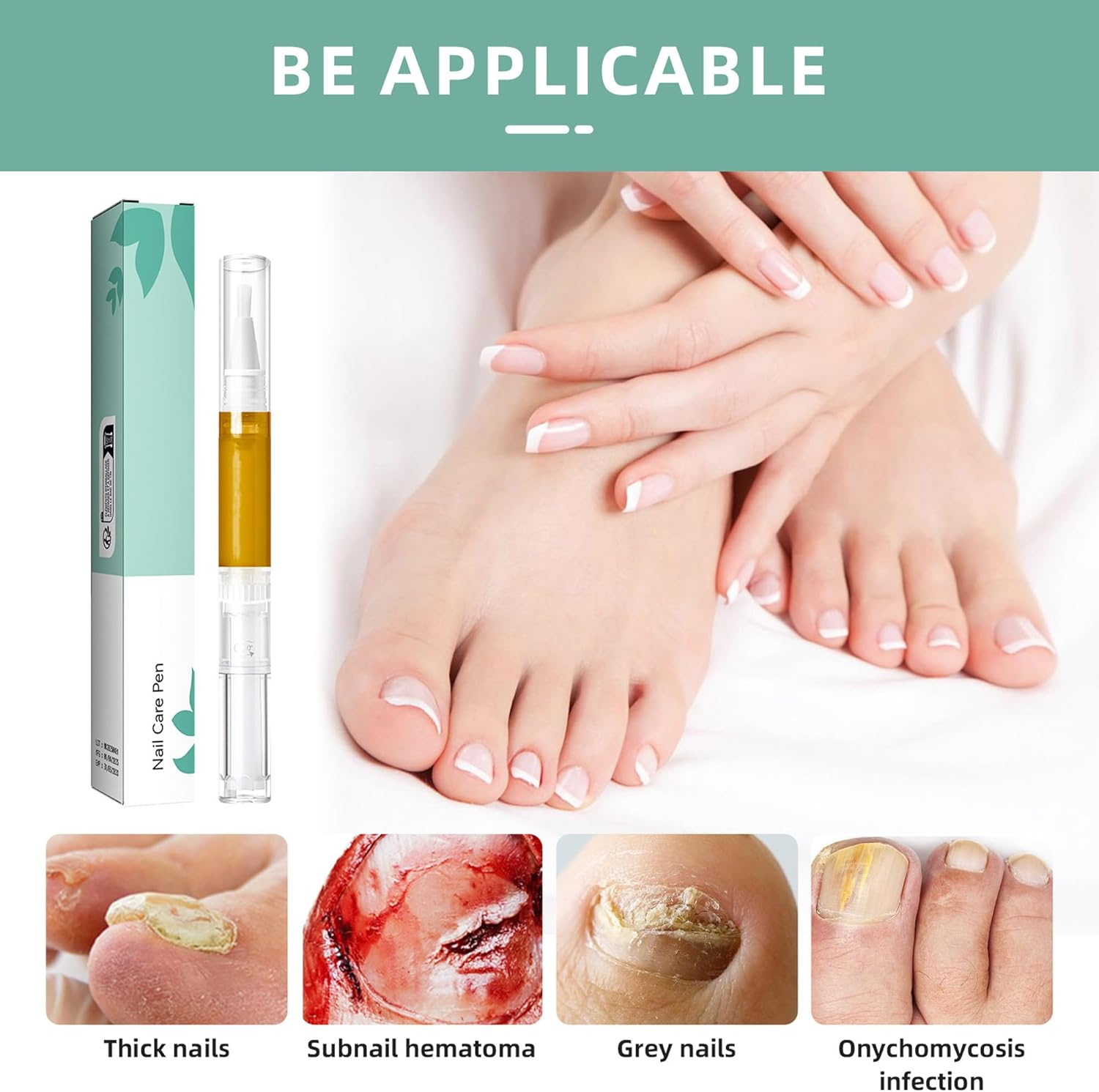 Depehelp 2Pcs Radiant Nail Growth Oil, Nail Strengthener, Cuticle Oil for Nails, Moisturize Strengthen Nail Care Oil, Nail Skin Edge Care