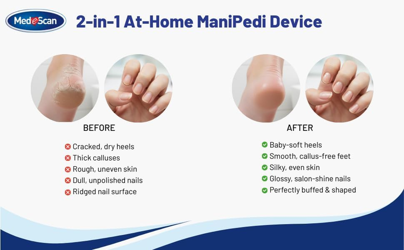 Medescan 2-In-1 Manipedi &ndash; Smooths Rough Heels and Buffs Nails &ndash; Two-Speed Motor with Safety Clutch &ndash; Water-Resistant, Interchangeable Heads, Includes Replacement Set