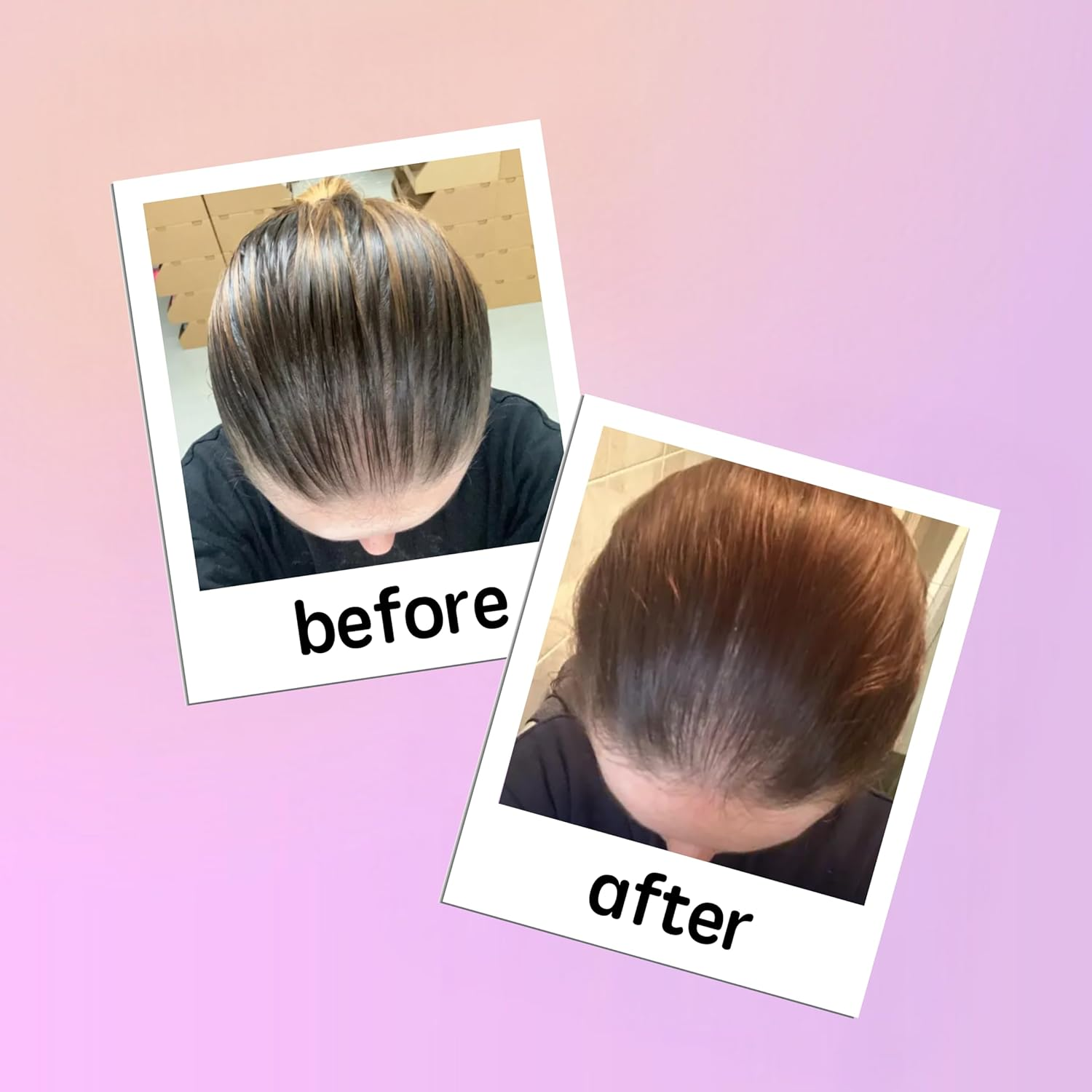 Georgiemane Hair Growth Serum | Scalp Treatment for Hair Loss & Density Boost | Promotes Thicker, Fuller & Stronger Hair | Lightweight, Non-Greasy Finish | Safe for Coloured & Bleached Hair, 30Ml image number 1