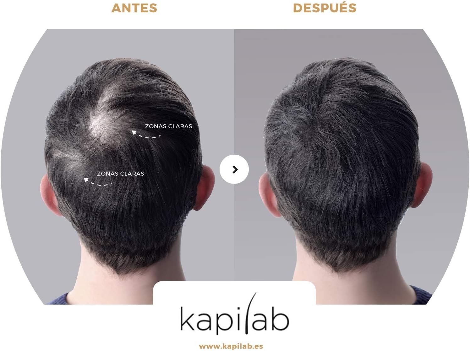 Kapilab Scalp Mask - 4G - Medium Brown image number 4