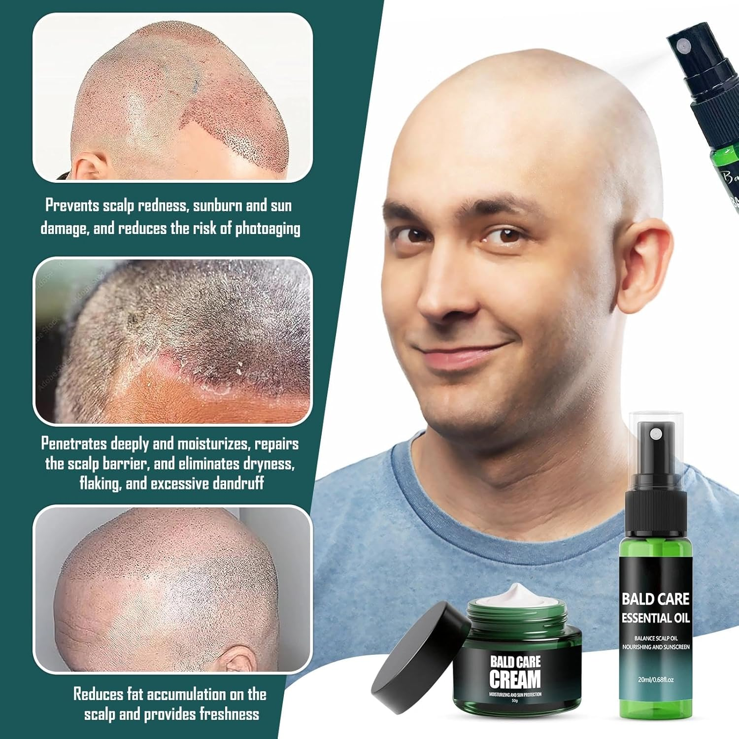 Pack of 2 Nourishing Bald Cream, Moisturising and Repairing Care, Scalp Care Cream, Natural Anti-Shine Effect, against Skin Irritation and Shaving Burn, Premium Care for Bald Wearers