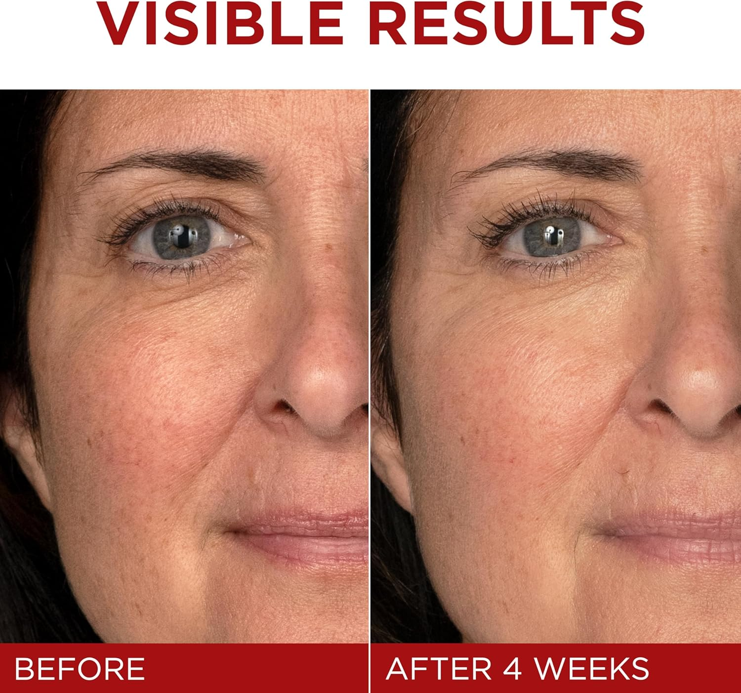 L&rsquo;Oreal Paris Skincare Revitalift Triple Power Fragrance-Free Face Moisturizer with Pro Retinol, Hyaluronic Acid & Vitamin C, Reduce Wrinkles, Firm and Brighten Skin, 2.55 Oz