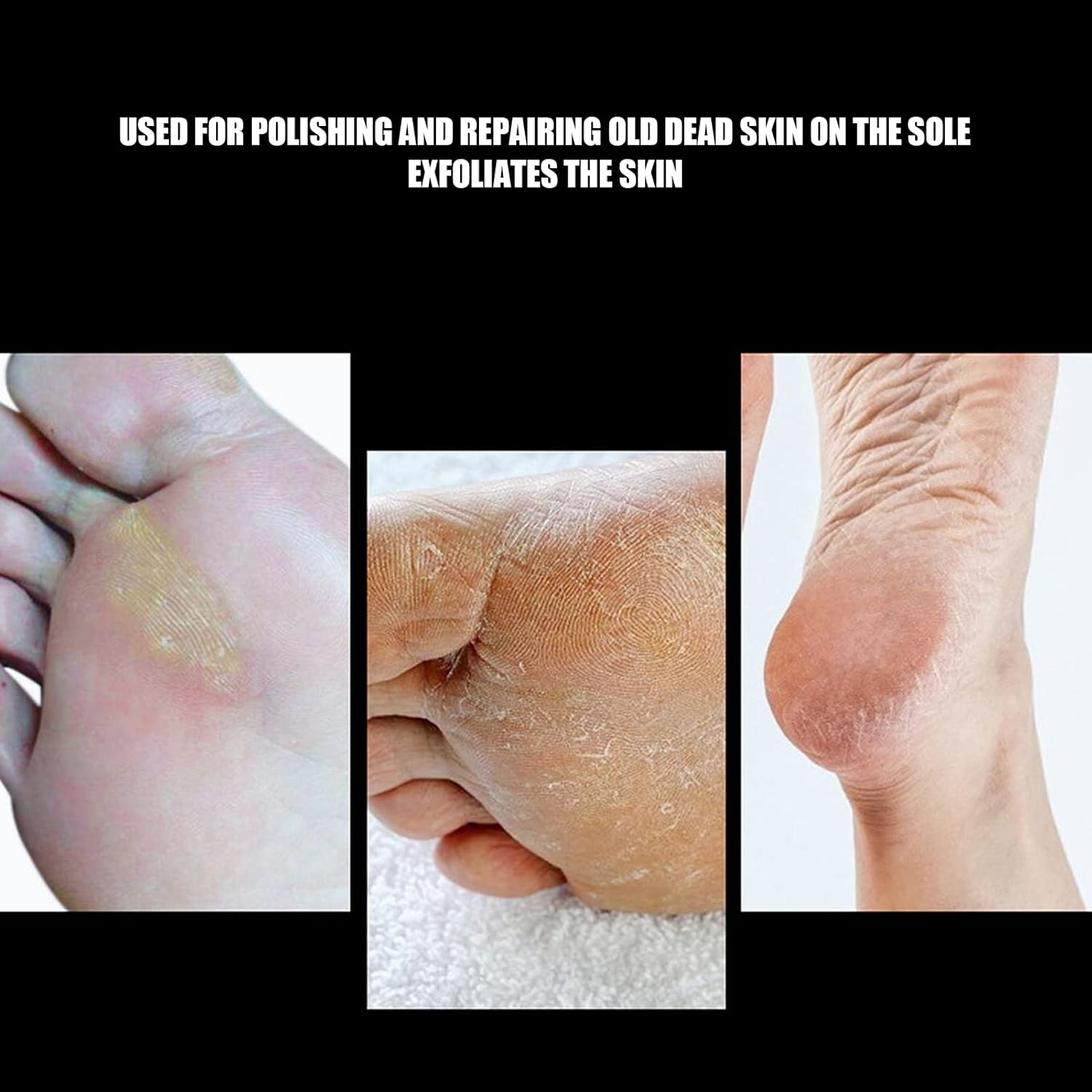 Nail Drill, Foot Dead Skin Removal Nail Drill, Pedicure Polishing Grinding Head Replacement Parts, Foot Calluses Drill (B1F) image number 2