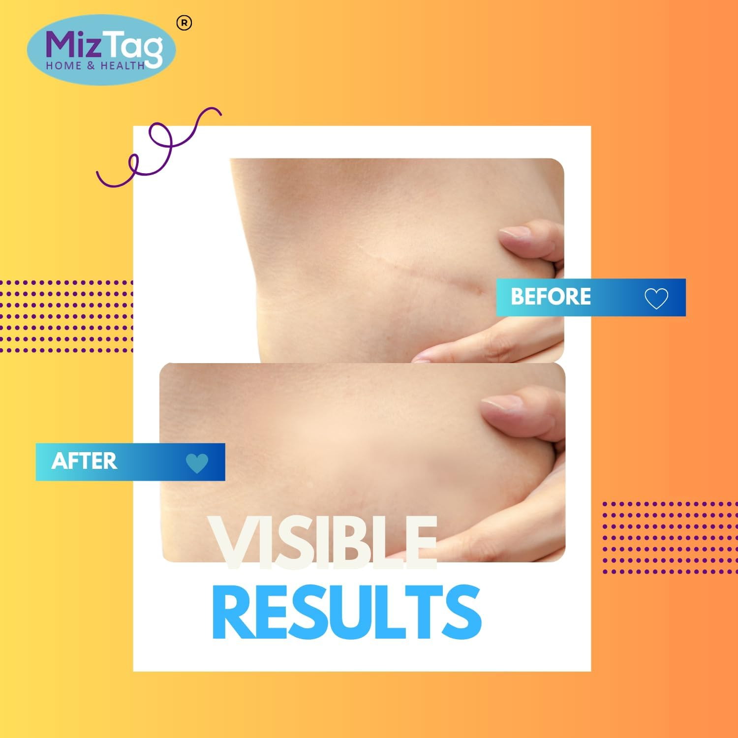 Post-Op Surgery Essentials for Breast Reduction and Augmentation - Silicone Sheets for Recovery - Comfortable Fit under Post-Op Bra (4 PCS)