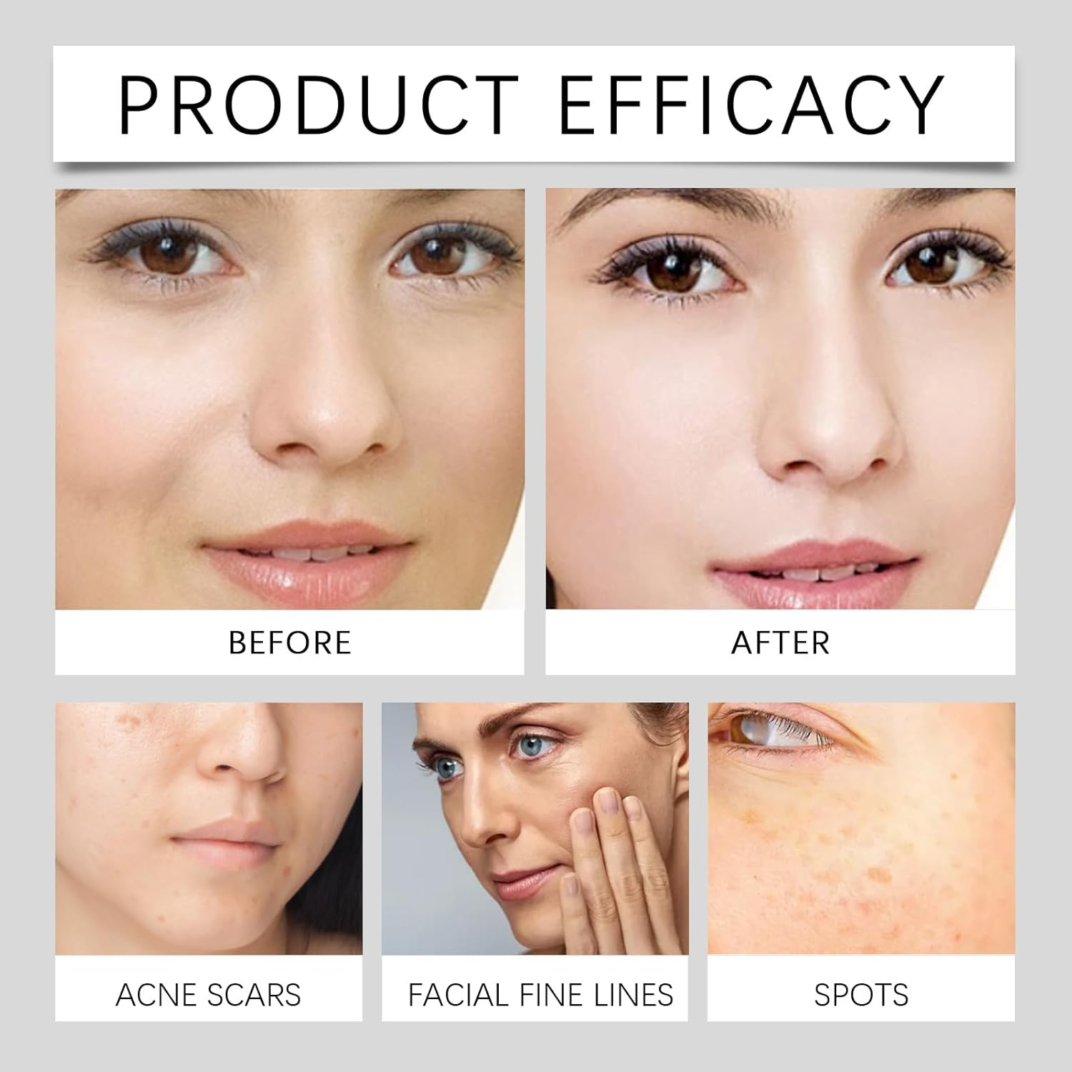 Aobenz Serum, Aobenz Spot Remover Serum, Aobenz Whitening and Freckle Removing Essence, Hydrating and Moisturizing, Gentle Dark Spot Remover, Face Serum for Women (1Pcs)