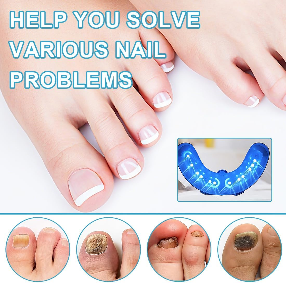 Tomedeks 1 X Nail Fungus Laser with Timer, Nail Fungus Laser Device, Infrared Strongest Effect, Fast Acting image number 6