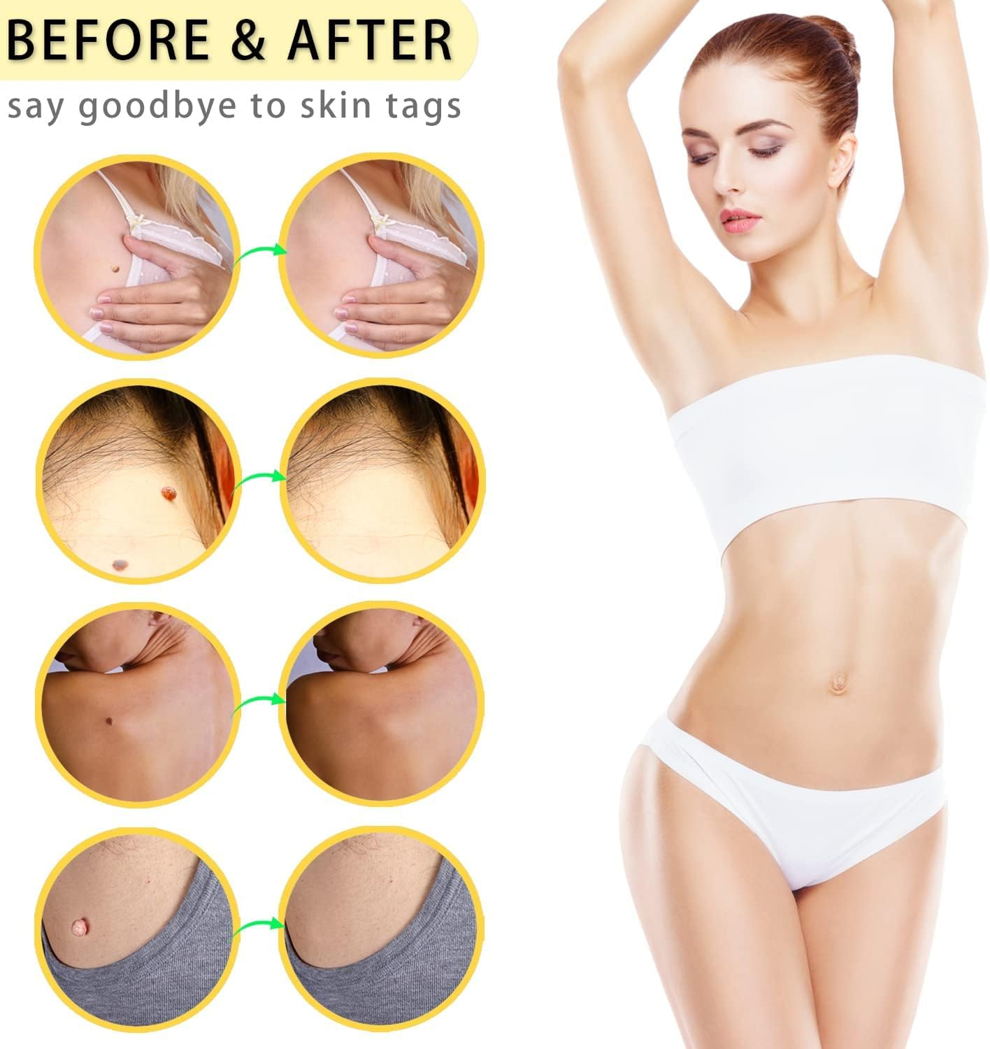 2-IN-1 Skin Tag Tool for 2-8 Mm Size Skin Tags Painless Skin Tag Removal Kit with 36 Repair Patches and 10 Cleansing Wipes Easy to Use for Most Body Parts image number 3