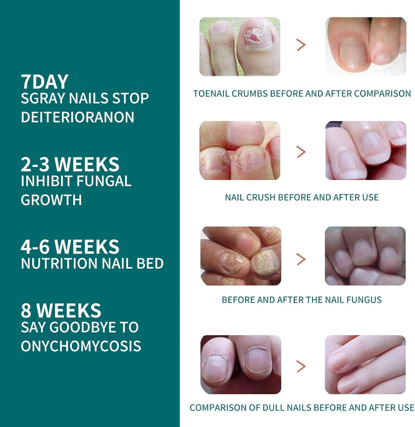 Nail Care Pen, Nail Care Pen Nail Fungus Pen Steiger Naturals Nail Care Pen Nail Fungus Pen Austria (Pack of 5) image number 4