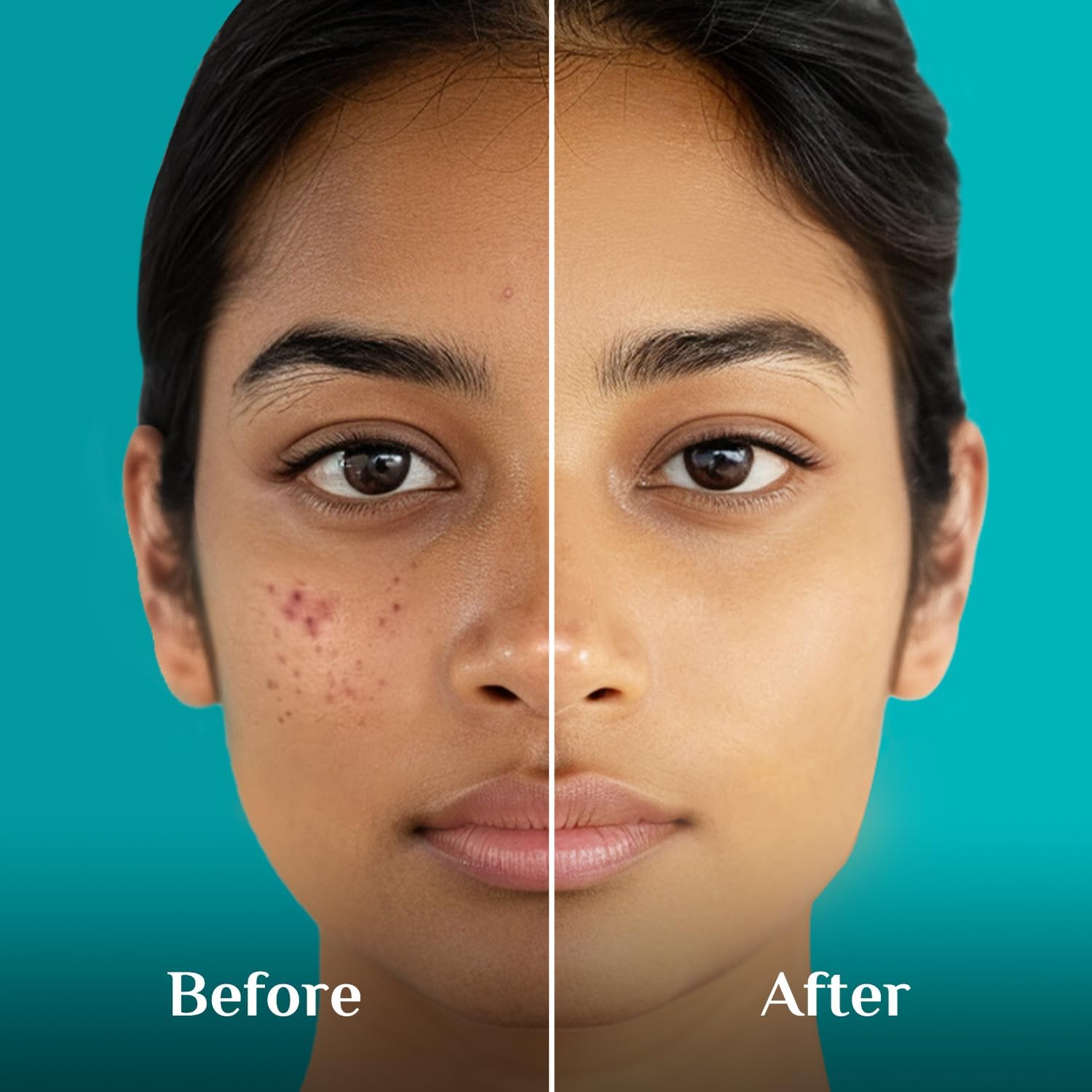 Pilgrim 10% Niacinamide Face Serum for Acne Marks for Unisex 30Ml Blue image number 1