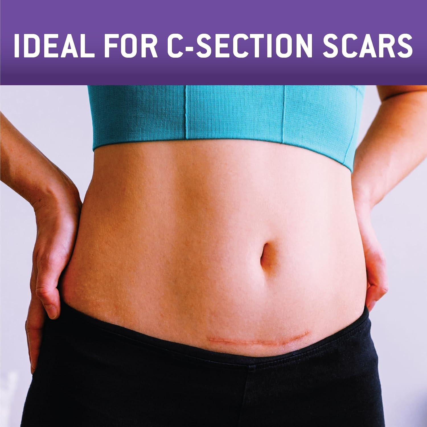 Care Science C Section Recovery Silicone Scar Sheets 1.5In X 7In 8Ct | Reuseable Scar Sheets for Reducing the Appearance of C-Section, Keloid, and Acne Scars image number 4