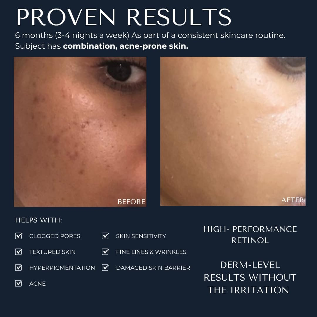 KAASHI 1% Retinol Night Treatment, Anti-Ageing Cream with Ceramides, Peptides & Botanical Extracts for Fine Lines, Uneven Texture & Dark Spots, for All Skin Types image number 5