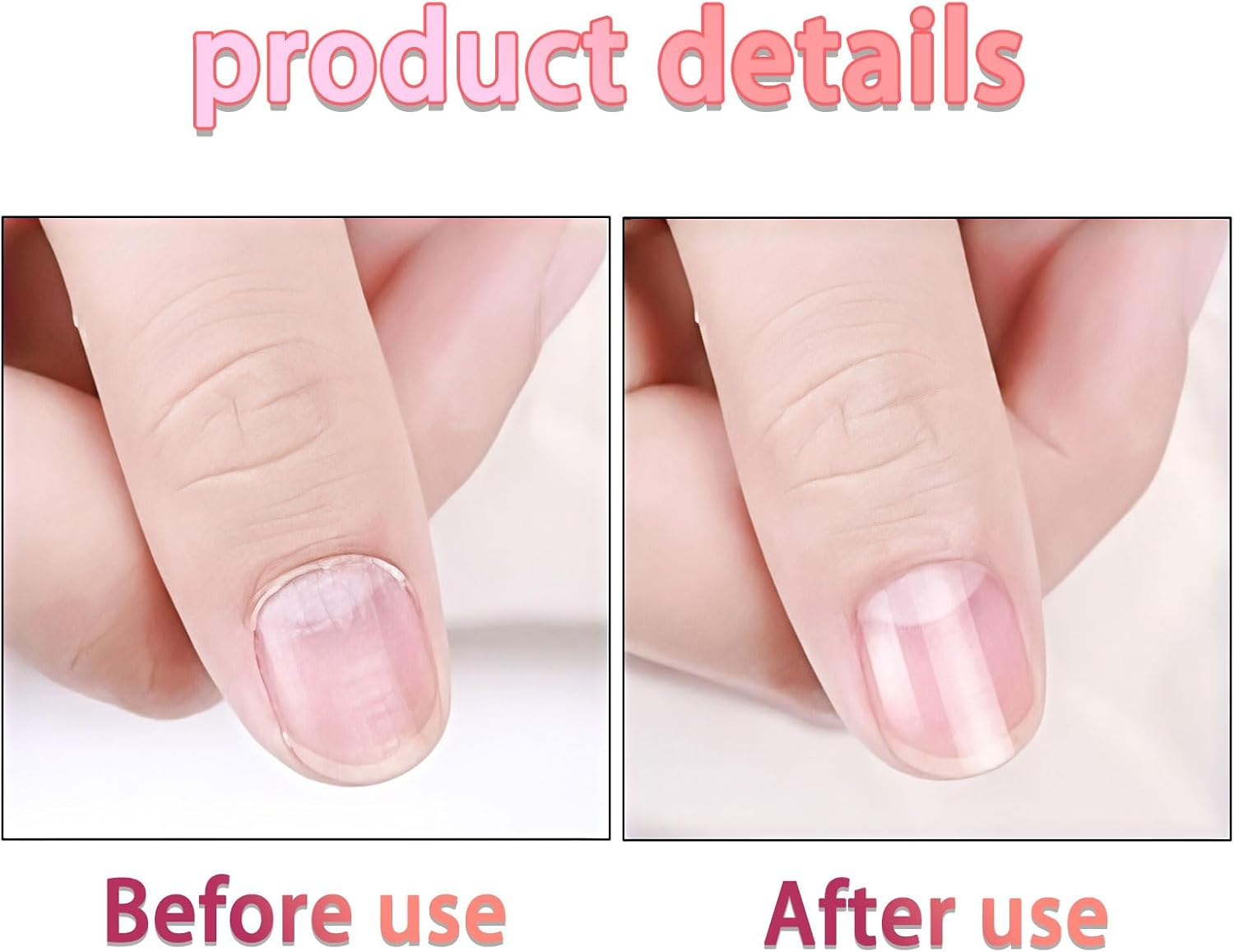 5 Pieces of Nail Oil Pen, Cuticle Oil Pen Nail Art Nourishing Oil Pen, Dead Skin Anti-Hangnail Nail Growth Essence Nail Strengthener, Nail Polish Keratin Layer for Daily Care and Repair of Cracked and Dry Nails