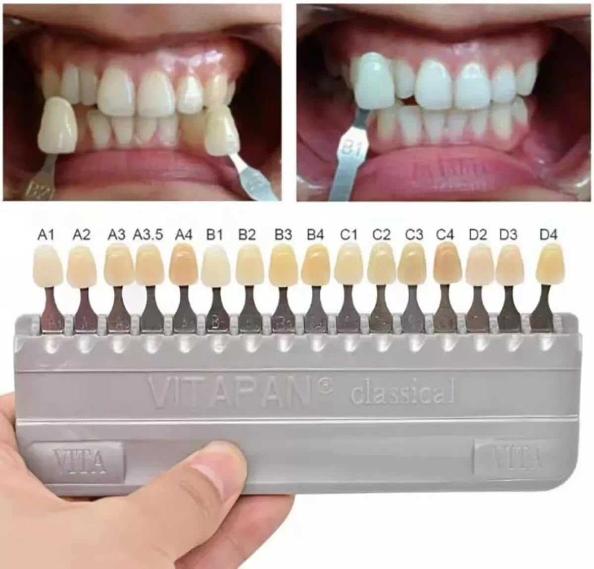 Smart Parts Store 3D-Master Teeth Whitening Shade Guide 16 Colors Set Replacement for Vita Classical Tooth Bleaching Shade Chart Mold - Tracking & Comparing - Dental Material Equipment - Oral Care image number 3