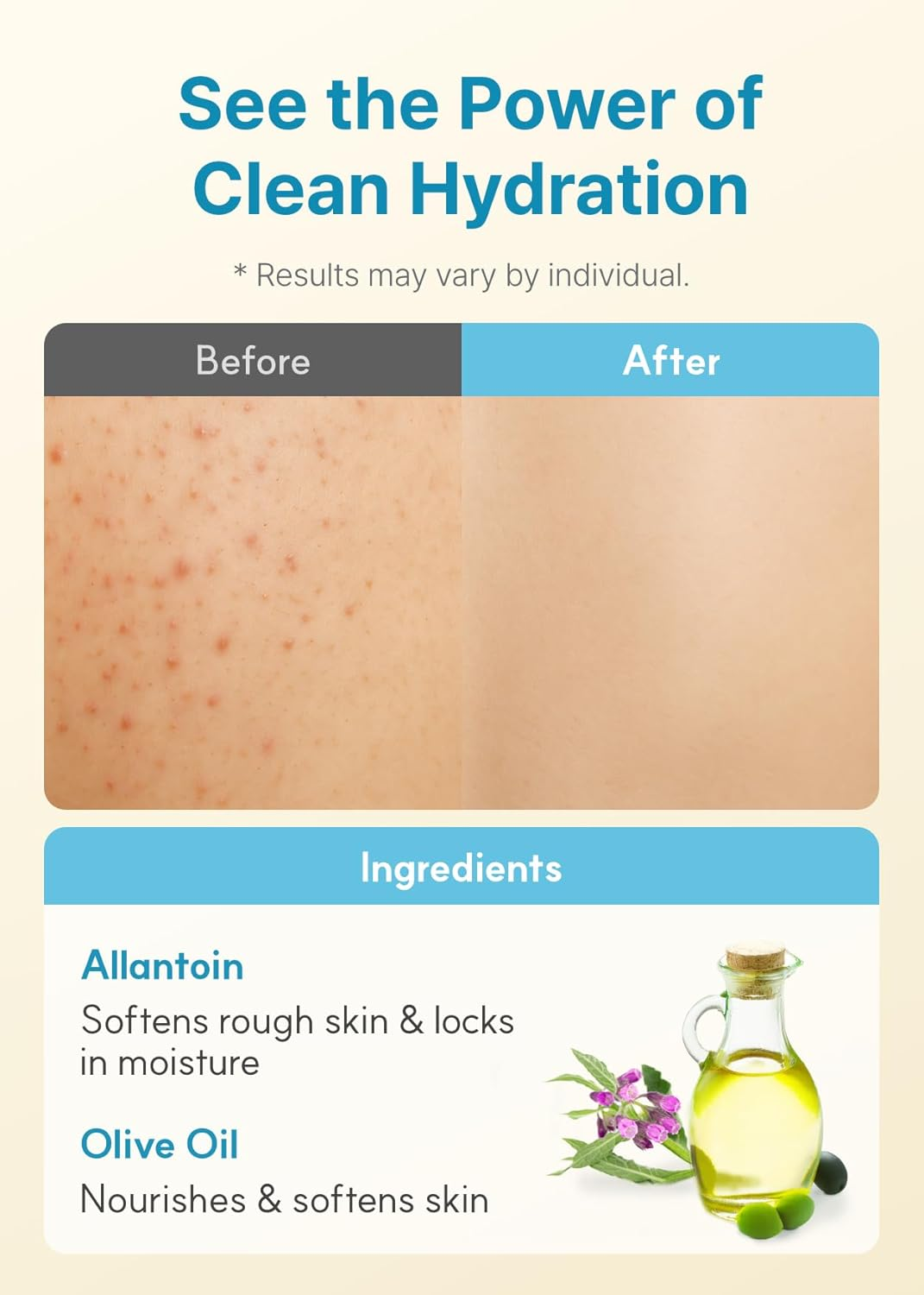 Derma:B Daily Moisture Body Lotion 400 Ml image number 3