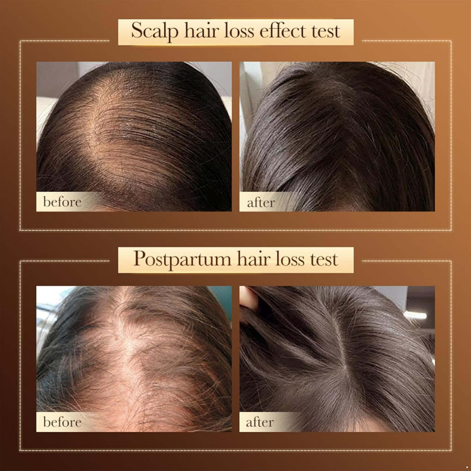 Yizyif Shampoo That Maintains Hair Balance, Clarifying Clean with Oil Control, Rich Sudsing for Everyone Coffee One Size image number 1