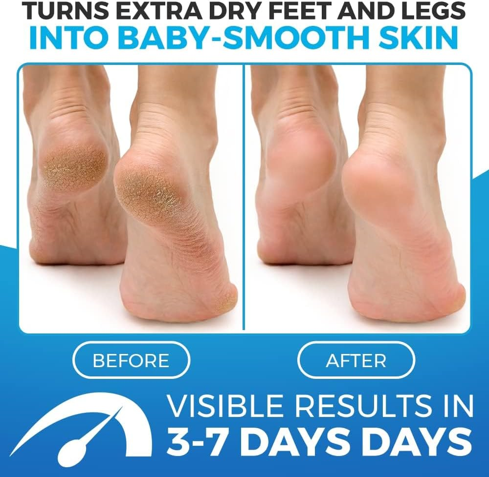 Imperial Feet Foot Balm Soft - Deep Moisturizing Cream for Dry Skin & Cracked Heels Repair - Honey & Yogurt Formula for Smooth Feet Remove Dead Skin-Hydrating, Fissures Treatment in Legs & Feet-150 ML image number 2