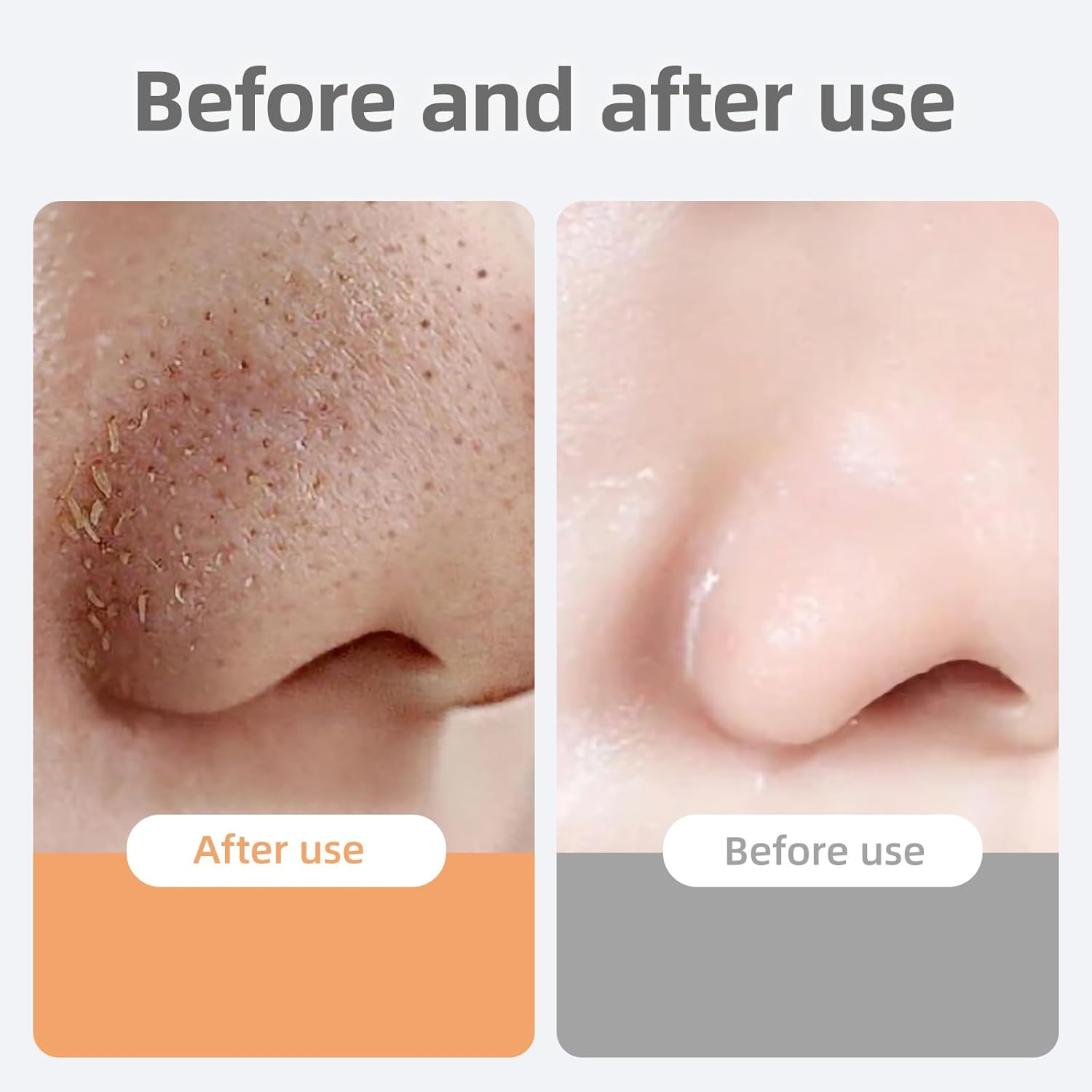 Hzqzaoan 2Pcs Blackhead Remover Tool, Silicone Face Scraper for Cleansing, Skin Scrubber Face Spatula, Face Black Head Remover for Nose, Skin Care Tools for Women/Men, Acne Pore Cleaner (Green + Pink) image number 5