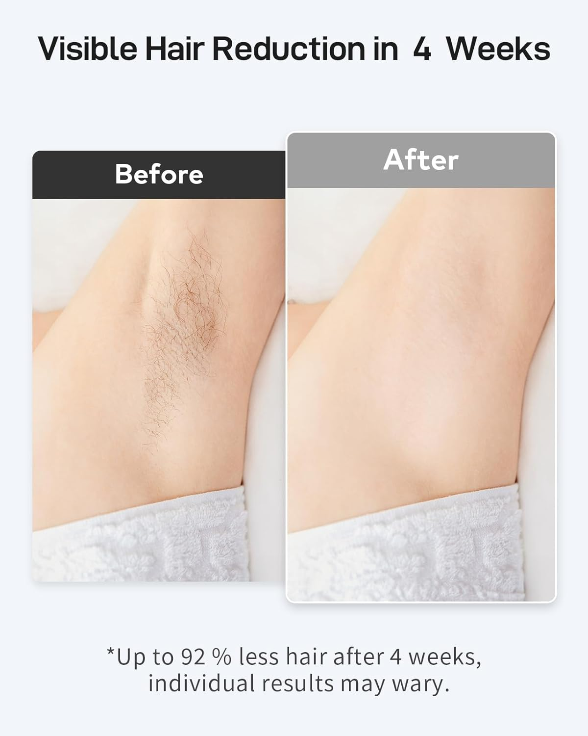 AMOTAOS IPL Hair Removal for Women and Men with Cooling, 3-In-1 Laser Hair Removal Device At-Home Permanent Upgrade 999900 Flashes 9 Levels Epilators for Face Armpits Arms Bikini Line Legs Whole Body image number 2