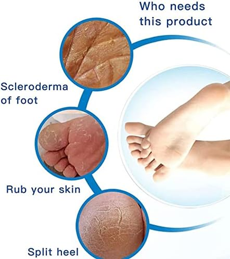 4 Pack Foot Pumice Stone, Double Sided Pumice Stone for Feet,Foot Remover and Pumice Pad, Hard Skin Callus Remover and Scrubber for Feet & Hands (Blue) - Purple image number 3