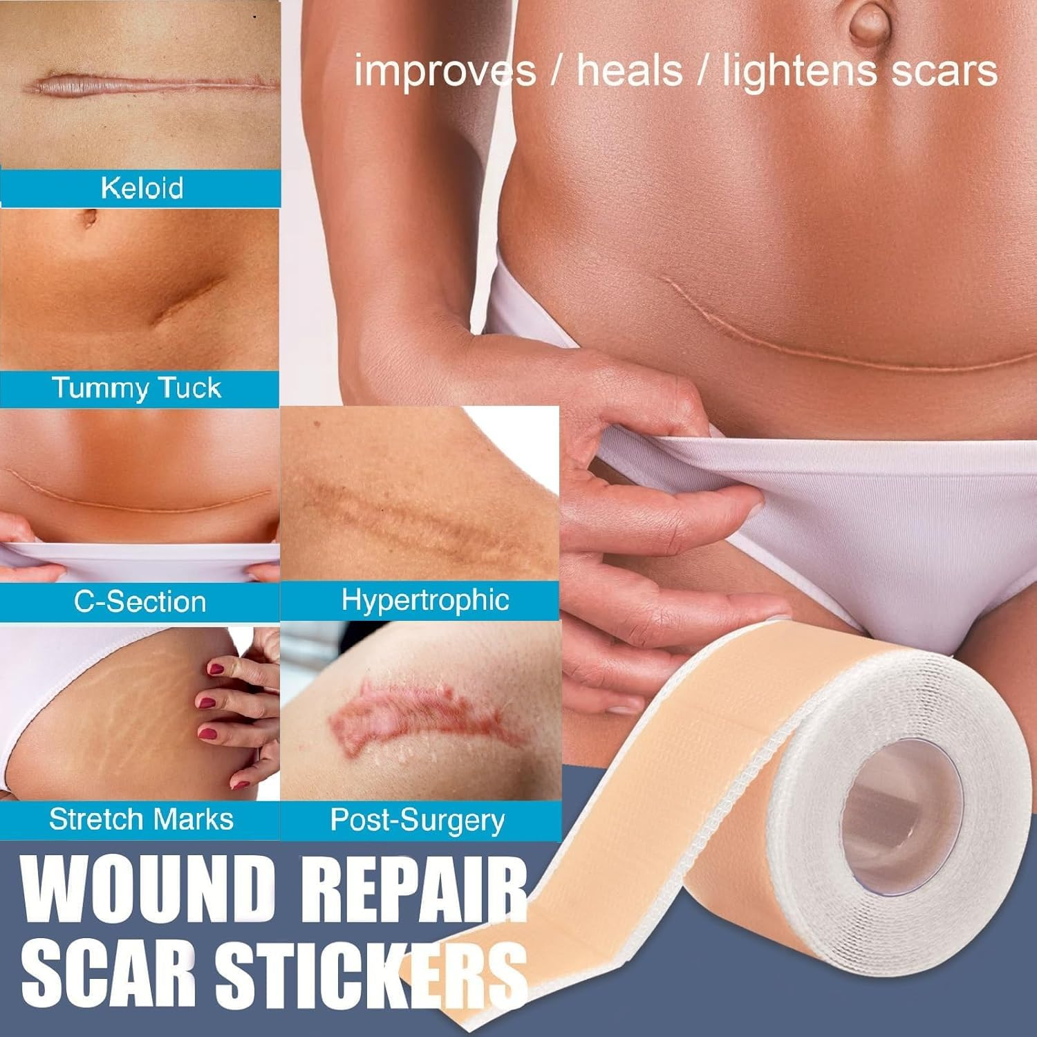 Silicone Scar Tape, Advanced Professional Removal Patch Strips, Reusable Sheets, for Keloid Scars, C Section, Burn, Scratch, Birthmarks, Tummy Tuck, Acne Etc., Works with Old and New Scar (4X150Cm Roll) image number 4