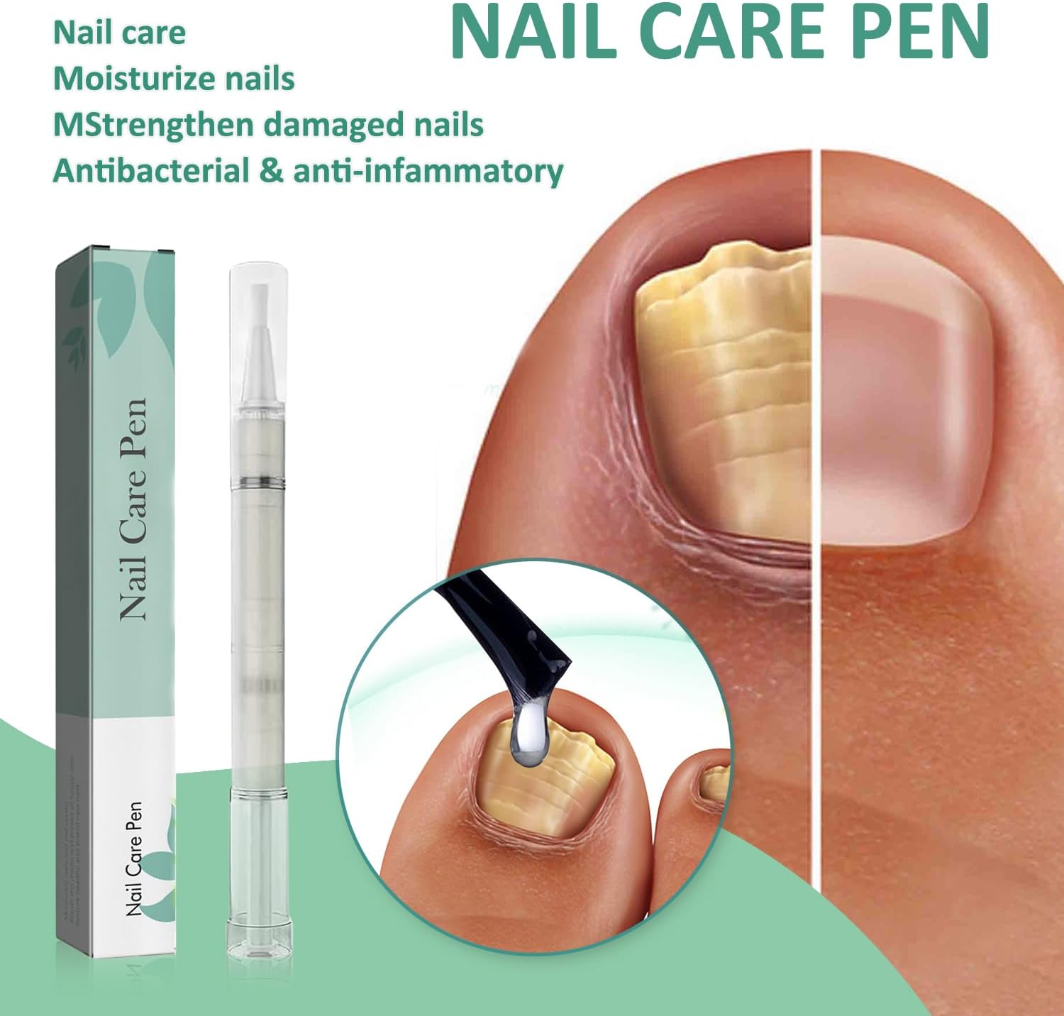Nail Care Pen, Nail Care Pen Nail Fungus Pen Steiger Naturals Nail Care Pen Nail Fungus Pen Austria (Pack of 5) image number 1