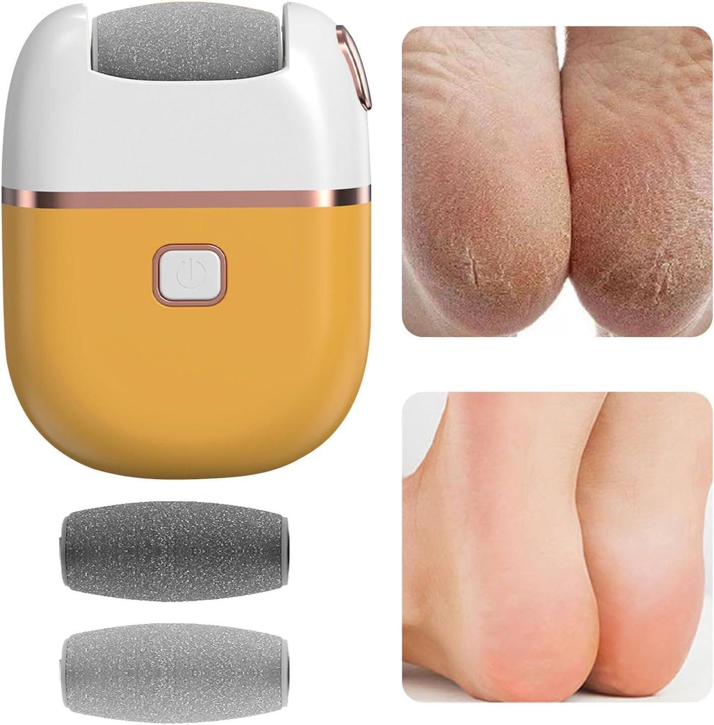 Electric Foot Scrubber File - Hard Skin Remover Foot, Electric Callus Remover Kit | Callus Remover with USB Charging for Dead Skin, Foot Care Tool Foot Scrubber File for Men Women (8.5X7Cm) - Yellow image number 1