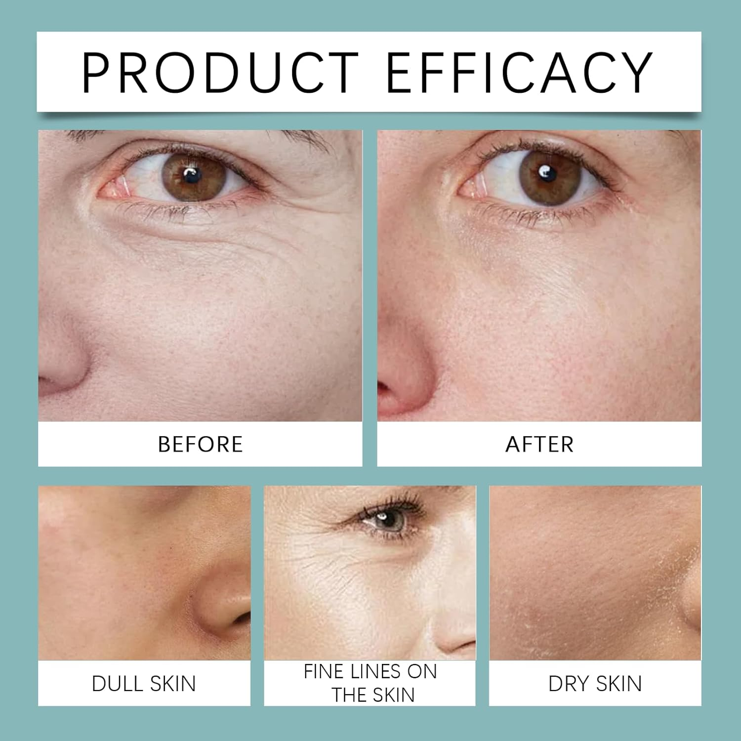 30G Anti-Wrinkle Cream Reduces Wrinkles | Daily Improve Skin Elasticity Delicate Skin Moisturizing Cream image number 4