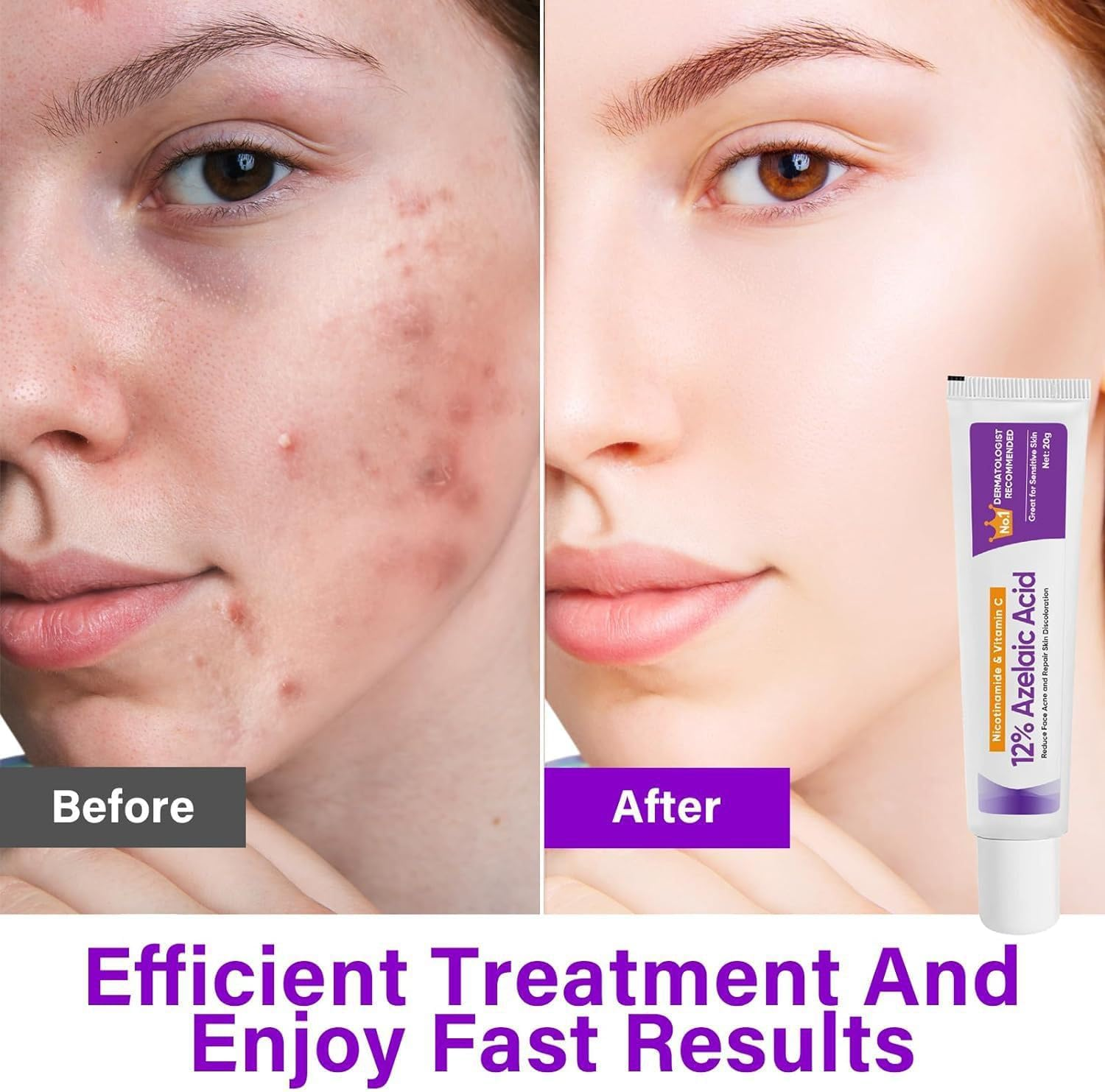 Azelaic Acid 12% Serum for Face with Niacinamide & Vitamin C Refining Skin Texture,Reduce Blemish Visibility,Support Skin Barrier Moisture Retention, Improve Tone Evenness (2 Packs) image number 2