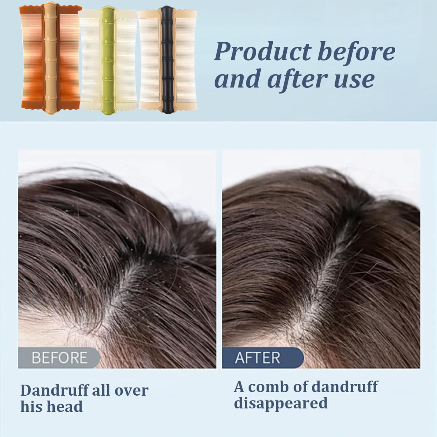 Dandruff Comb 3PCS PP Bamboo Styling Double-Sided Fine Teeth Lice Comb Thick Hair Flea Comb Comfortable Lice Brush for Kids Adults 4.9X2.8 Inch Flea Comb Lice Combs for Thick Hair Lice Comb image number 3