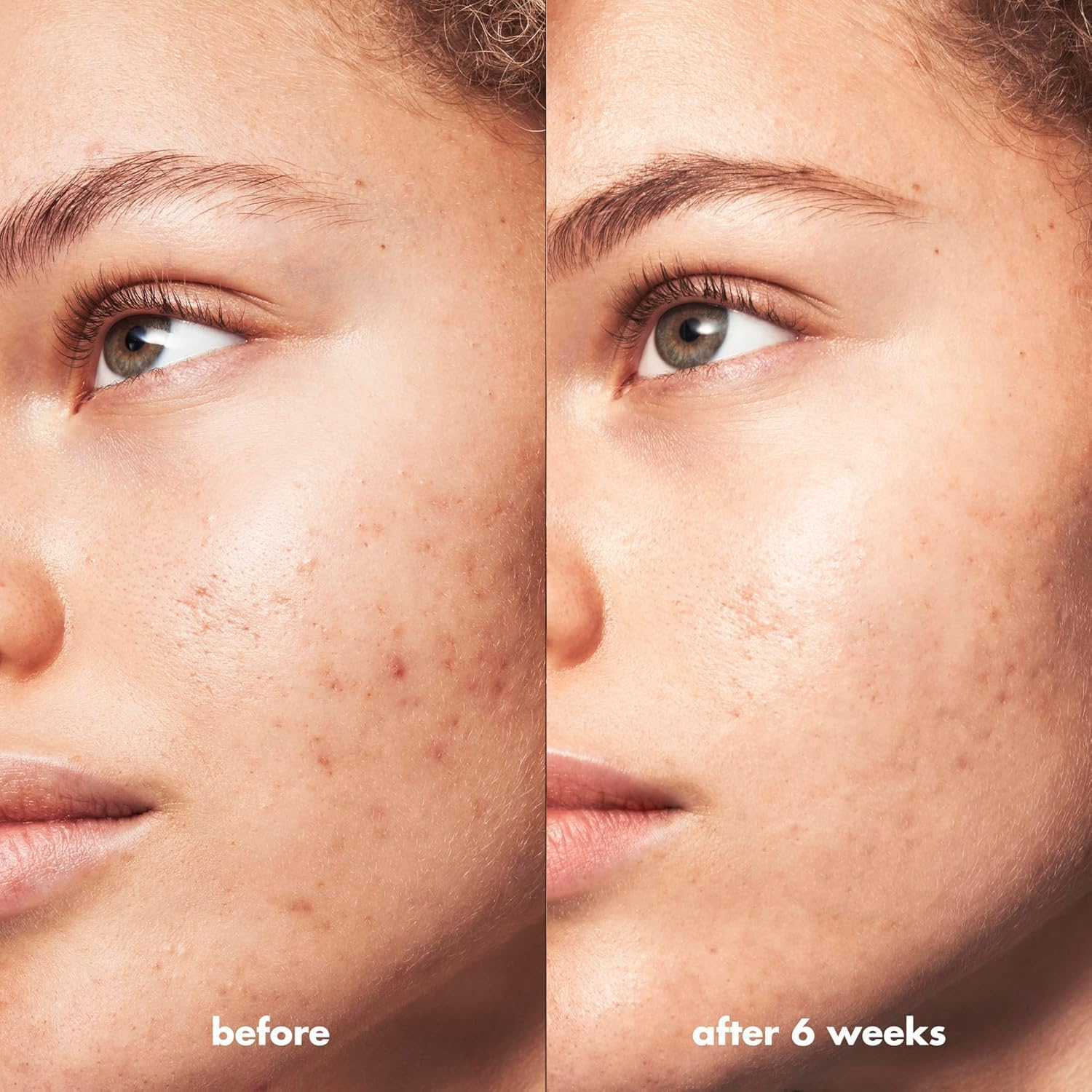 E.L.F. SKIN Blemish Breakthrough Calming Water Cream, Lightweight Blemish-Fighting Face Moisturiser, Prevents New Blemishes & Calms Skin image number 2