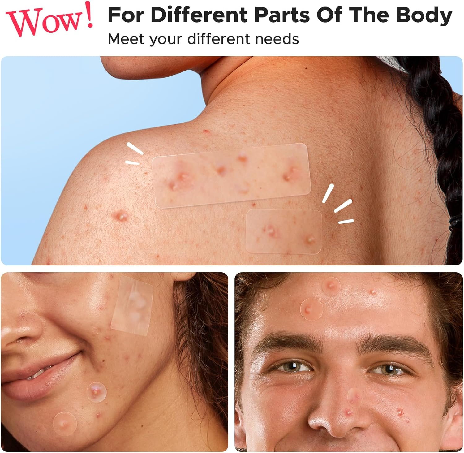 Litbear Large Pimple Patches, 5 Sizes 156 Patches Big Acne Patch, 60 XL Hydrocolloid Patch for Full Face, Forehead, Chin, Nose, Body, Back, Neck & Chest, Stirp, Square Large Hydrocolloid Bandages image number 6