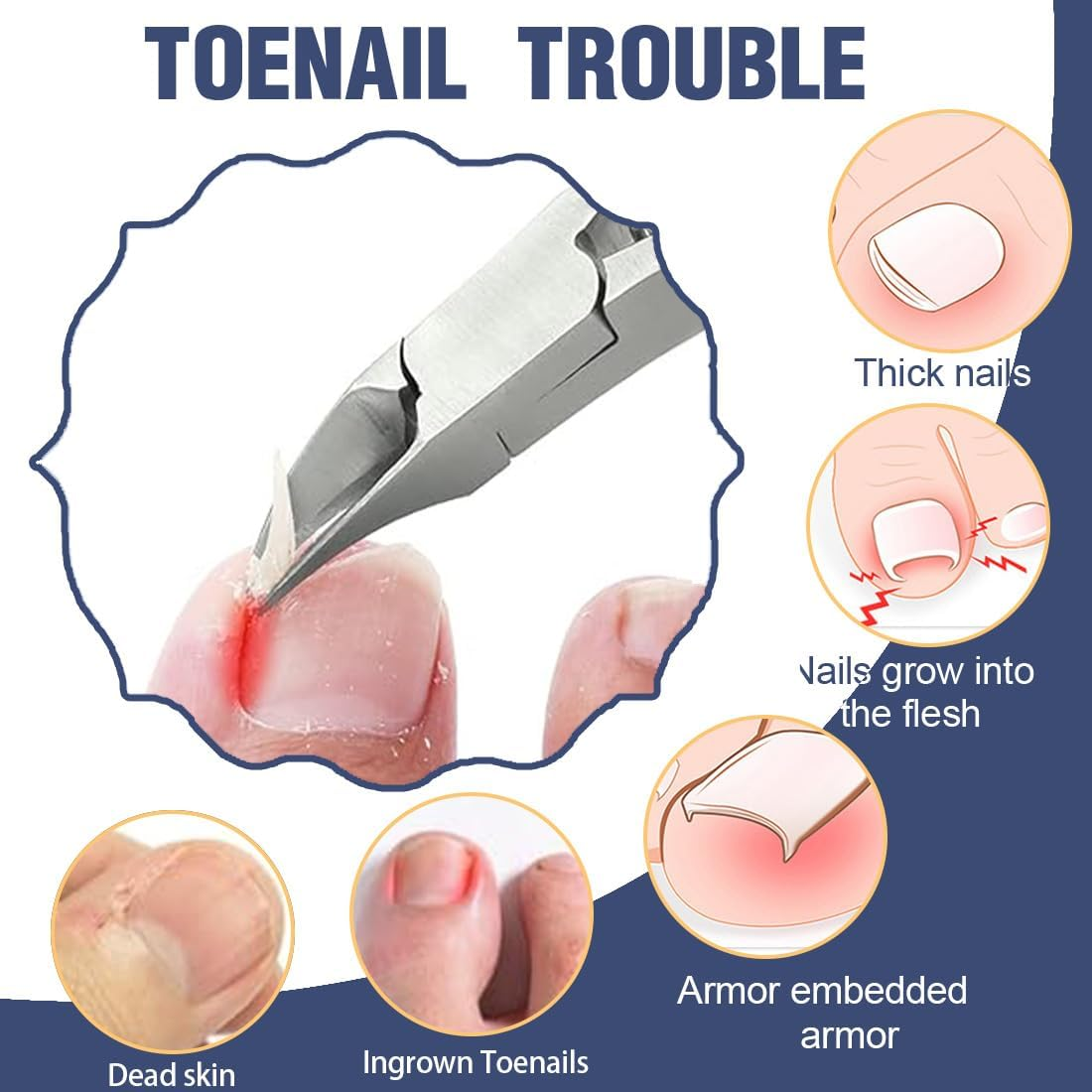 Precision Toenail Clippers, Metal Nail Clippers, Nail Scissors for Thick and Deep Ingrown Toenails, Toehenic Acid Clippers Made of Stainless Steel, Professional Fingernail Clipper, Soft Grip image number 4