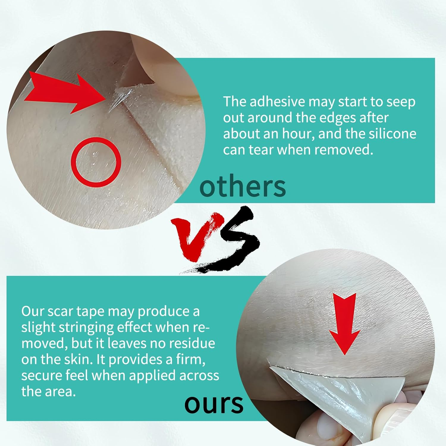 Silicone Scar Tape, Soft Silicone Scar Sheets, Reusable Medical Grade Scar Gel Patch Strips Roll for Wrinkles, Tummy Tuck, Surgical Marks, C-Section, Keloid Bump Removal, 1.6'' X 60'' image number 4