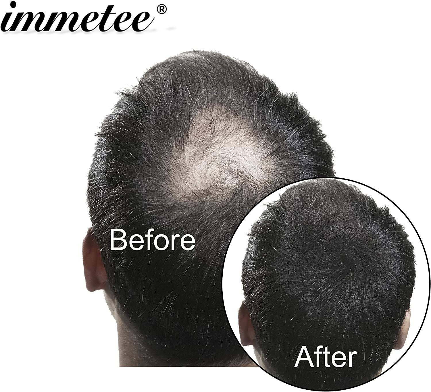 Immetee Hair Building Fibres Powder, Hairline Powder Black, Hair Fibres for for Thinning Hair, Conceals Hair Loss in 30 Sec, Hair Thickener for Women & Men​ (28G Black) image number 2